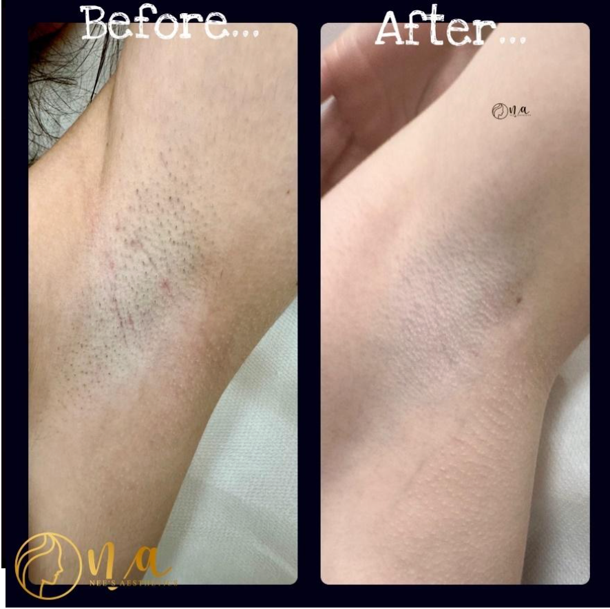 Patch test and consultation