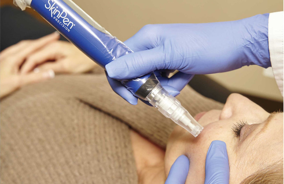 Medical Microneedling – Nee'sAesthetics