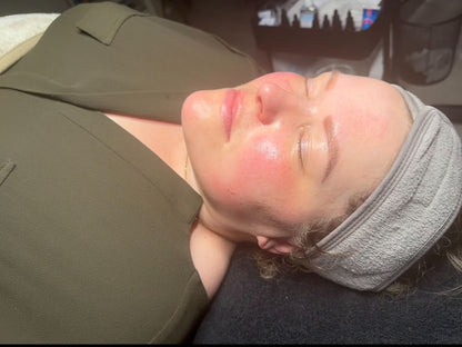 Pure Chemical Peel (40%)