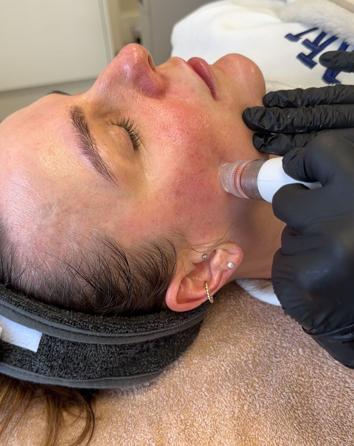 Hydra Supra Rash The Ultimate Hydra-facial – Nee'sAesthetics