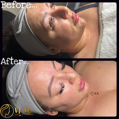 Cinderella Facial