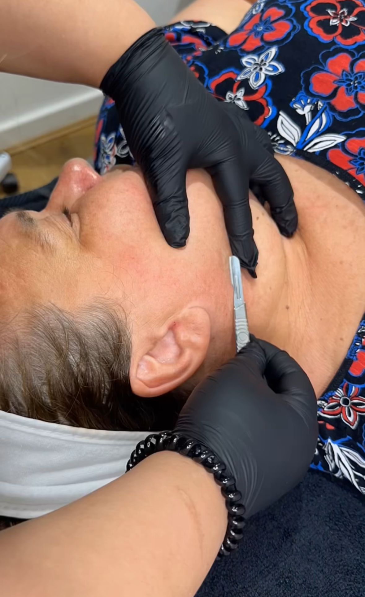 Dermaplaning Facial